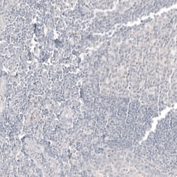 Invitrogen CDX2 Monoclonal Antibody (CL12974) 100 &mu;L; Unconjugated:Antibodies,