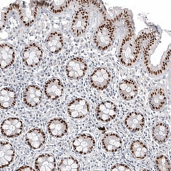 Invitrogen CDX2 Monoclonal Antibody (CL12974) 100 &mu;L; Unconjugated:Antibodies,