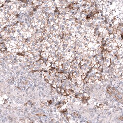 Invitrogen Glypican 3 Monoclonal Antibody (CL12711) 100 &mu;L; Unconjugated:Antibodies,