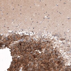 Invitrogen Calretinin Monoclonal Antibody (CL12836) 100 &mu;L; Unconjugated:Antibodies,