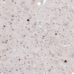 Invitrogen Calretinin Monoclonal Antibody (CL12836) 100 &mu;L; Unconjugated:Antibodies,