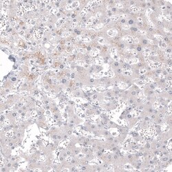Invitrogen Calretinin Monoclonal Antibody (CL12836) 100 &mu;L; Unconjugated:Antibodies,