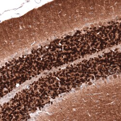 Invitrogen Calretinin Monoclonal Antibody (CL12836) 100 &mu;L; Unconjugated:Antibodies,