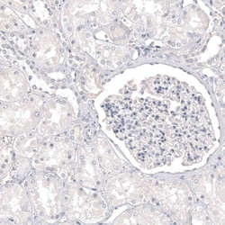Invitrogen Melan-A Monoclonal Antibody (CL12863) 100 &mu;L; Unconjugated:Antibodies,