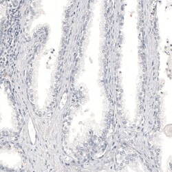 Invitrogen Melan-A Monoclonal Antibody (CL12863) 100 &mu;L; Unconjugated:Antibodies,