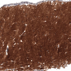 Invitrogen CD171 (L1CAM) Monoclonal Antibody (CL12984) 100 &mu;L; Unconjugated:Antibodies,