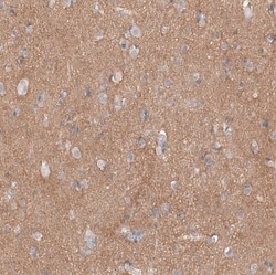 Invitrogen CD171 (L1CAM) Monoclonal Antibody (CL12984) 100 &mu;L; Unconjugated:Antibodies,