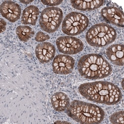 Invitrogen Claudin 3 Monoclonal Antibody (CL13128) 100 &mu;L; Unconjugated:Antibodies,