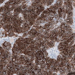 Invitrogen Claudin 3 Monoclonal Antibody (CL13128) 100 &mu;L; Unconjugated:Antibodies,