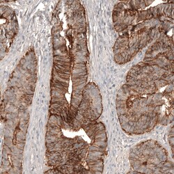 Invitrogen Claudin 3 Monoclonal Antibody (CL13130) 100 &mu;L; Unconjugated:Antibodies,