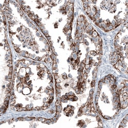 Invitrogen Claudin 3 Monoclonal Antibody (CL13130) 100 &mu;L; Unconjugated:Antibodies,