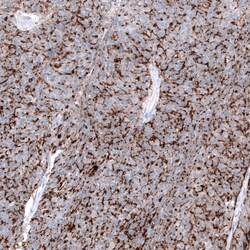 Invitrogen Claudin 3 Monoclonal Antibody (CL13130) 100 &mu;L; Unconjugated:Antibodies,