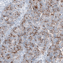 Invitrogen Claudin 3 Monoclonal Antibody (CL13130) 100 &mu;L; Unconjugated:Antibodies,