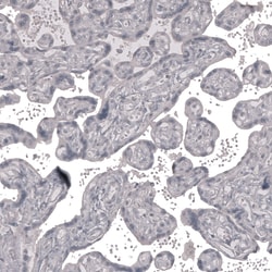 Invitrogen Claudin 3 Monoclonal Antibody (CL13130) 100 &mu;L; Unconjugated:Antibodies,