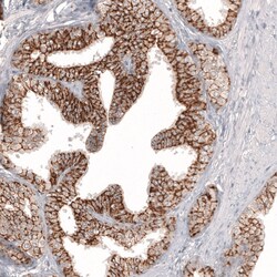 Invitrogen Claudin 3 Monoclonal Antibody (CL13130) 100 &mu;L; Unconjugated:Antibodies,