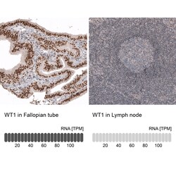 Invitrogen WT1 Monoclonal Antibody (CL13165) 100 &mu;L; Unconjugated:Antibodies,