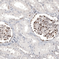Invitrogen WT1 Monoclonal Antibody (CL13165) 100 &mu;L; Unconjugated:Antibodies,