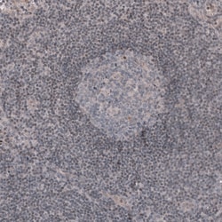 Invitrogen WT1 Monoclonal Antibody (CL13165) 100 &mu;L; Unconjugated:Antibodies,