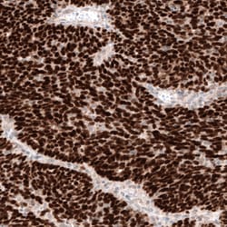 Invitrogen WT1 Monoclonal Antibody (CL13165) 100 &mu;L; Unconjugated:Antibodies,