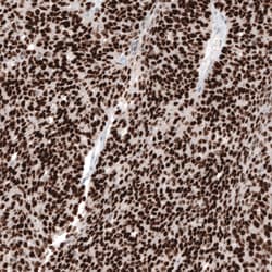 Invitrogen WT1 Monoclonal Antibody (CL13165) 100 &mu;L; Unconjugated:Antibodies,