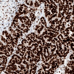Invitrogen WT1 Monoclonal Antibody (CL13165) 100 &mu;L; Unconjugated:Antibodies,