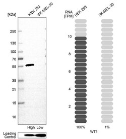 Invitrogen WT1 Monoclonal Antibody (CL13165) 100 &mu;L; Unconjugated:Antibodies,
