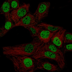 Invitrogen WT1 Monoclonal Antibody (CL13176) 100 &mu;L; Unconjugated:Antibodies,