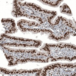 Invitrogen WT1 Monoclonal Antibody (CL13176) 100 &mu;L; Unconjugated:Antibodies,