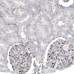 Invitrogen WT1 Monoclonal Antibody (CL13176) 100 &mu;L; Unconjugated:Antibodies,