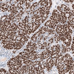 Invitrogen WT1 Monoclonal Antibody (CL13176) 100 &mu;L; Unconjugated:Antibodies,