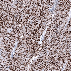 Invitrogen WT1 Monoclonal Antibody (CL13176) 100 &mu;L; Unconjugated:Antibodies,