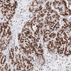 Invitrogen WT1 Monoclonal Antibody (CL13176) 100 &mu;L; Unconjugated:Antibodies,