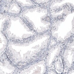 Invitrogen WT1 Monoclonal Antibody (CL13176) 100 &mu;L; Unconjugated:Antibodies,