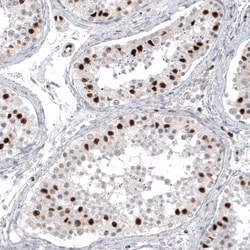 Invitrogen WT1 Monoclonal Antibody (CL13176) 100 &mu;L; Unconjugated:Antibodies,