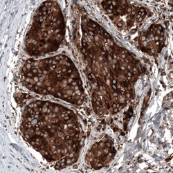 Invitrogen GSPT1 Monoclonal Antibody (CL13332) 100 &mu;L; Unconjugated:Antibodies,