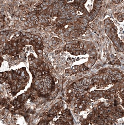 Invitrogen GSPT1 Monoclonal Antibody (CL13332) 100 &mu;L; Unconjugated:Antibodies,