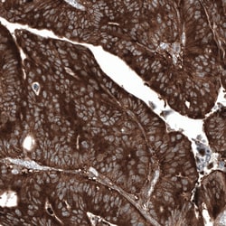 Invitrogen GSPT1 Monoclonal Antibody (CL13332) 100 &mu;L; Unconjugated:Antibodies,