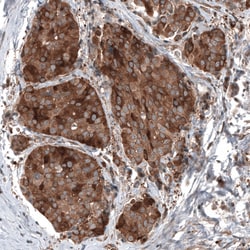 Invitrogen GSPT1 Monoclonal Antibody (CL13336) 100 &mu;L; Unconjugated:Antibodies,