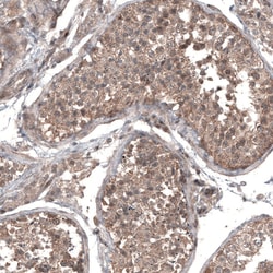 Invitrogen GSPT1 Monoclonal Antibody (CL13336) 100 &mu;L; Unconjugated:Antibodies,