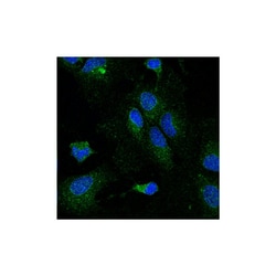 Invitrogen LPL Monoclonal Antibody (5D2), HRP 50 &mu;g; HRP:Antibodies,