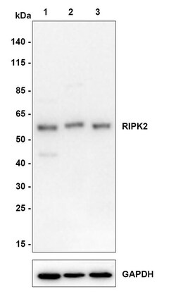 Invitrogen RIP2 Recombinant Rabbit Monoclonal Antibody (JE51-90) 100 &mu;L;