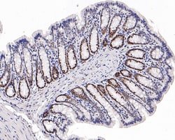 Invitrogen EZH1 Recombinant Rabbit Monoclonal Antibody (PS01-09) 100 &mu;L;