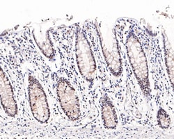 Invitrogen EZH1 Recombinant Rabbit Monoclonal Antibody (PS01-09) 100 &mu;L;