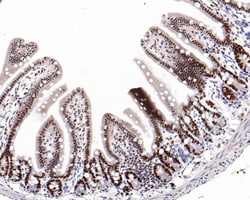 Invitrogen EZH1 Recombinant Rabbit Monoclonal Antibody (PS01-09) 100 &mu;L;