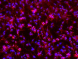 Invitrogen CD146 Recombinant Rabbit Monoclonal Antibody (044), PE 100 Tests;