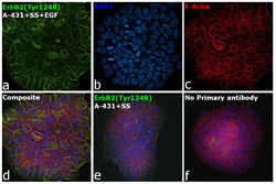 Invitrogen Phospho-ErbB2 (HER-2) (Tyr1248) Recombinant Rabbit Monoclonal