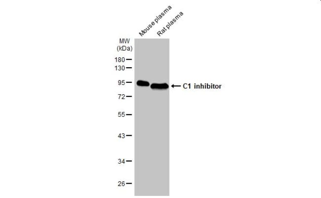 C1 inhibitor Monoclonal Antibody (HL1196), Invitrogen 100 μL ...