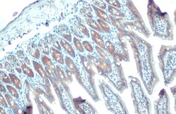 YTHDF2 Recombinant Rabbit Monoclonal Antibody (HL1355), Invitrogen 100 &mu;L | Buy Online | Thermo Scientific | Fisher Scientific