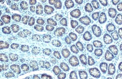 YTHDF2 Recombinant Rabbit Monoclonal Antibody (HL1355), Invitrogen 100 &mu;L | Buy Online | Thermo Scientific | Fisher Scientific