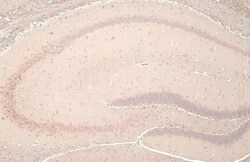 YTHDF2 Recombinant Rabbit Monoclonal Antibody (HL1355), Invitrogen 100 &mu;L | Buy Online | Thermo Scientific | Fisher Scientific